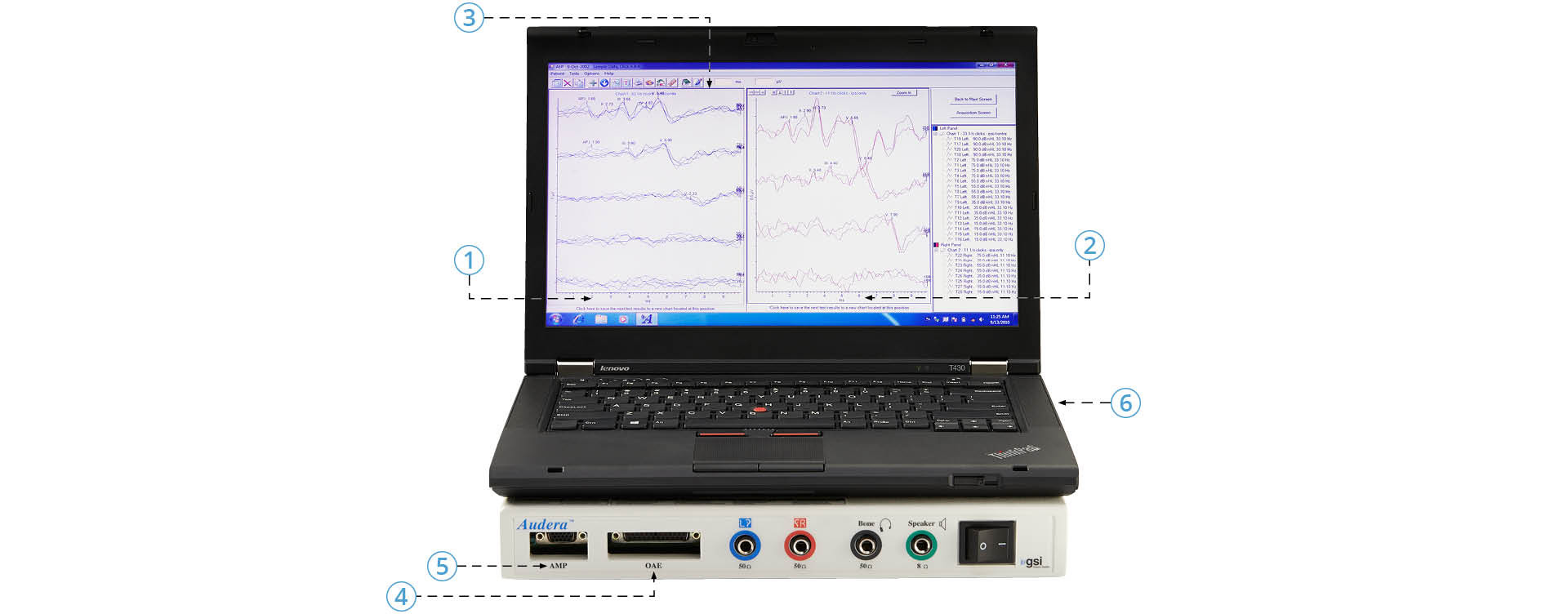 GSI Audera Product Features